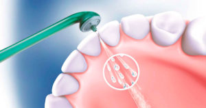 Как выбрать ирригатор для полости рта – ттт‹ЂЉЋЊЉЂттты стоматологов