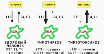 Свободный, связанный и общий Т4 — в чем разница?